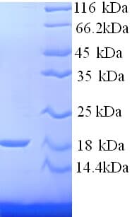 Mouse Hbb-b2 Protein (Recombinant His)
