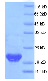 Human HPV16 E6 Protein (Recombinant 6His, N-terminus)