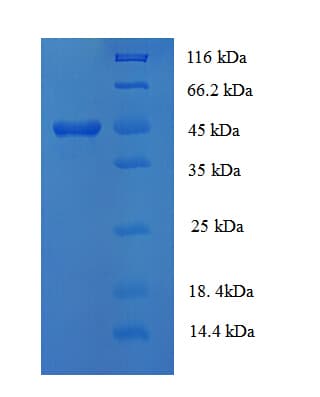 Bovine Serpin A3-2 Protein (Recombinant His)