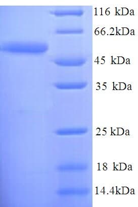 Salmonella heidelberg dsdA / D-serine dehydratase Protein (Recombinant His)