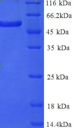 Human Delta3 / DLL3 Protein (Recombinant 6His, N-terminus)
