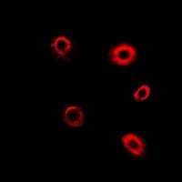 TBRG4 Antibody