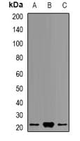 PSMB9 Antibody