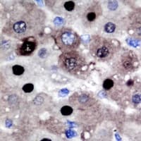 PRMT2 Antibody