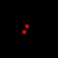 PRDM5 Antibody