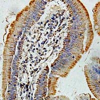 HMGCL Antibody