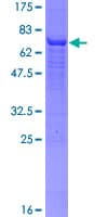 Human ACPP / PAP Protein (Recombinant GST)