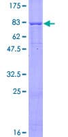 Human ACVR1B / ALK4 Protein (Recombinant GST)