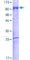 Human AFM / Afamin Protein (Recombinant GST)