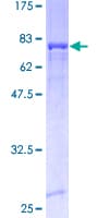 Human ALDH3A1 Protein (Recombinant GST)
