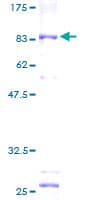 Human ALDH3A2 Protein (Recombinant GST)
