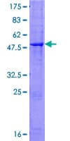 Human Antithrombin-III Protein (Recombinant GST)