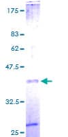 Human B2M / Beta 2 Microglobulin Protein (Recombinant GST)