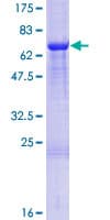 Human C21orf2 Protein (Recombinant GST)