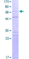 Human CASP1 / Caspase 1 Protein (Recombinant GST)