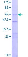 Human CASP2 / Caspase 2 Protein (Recombinant GST)