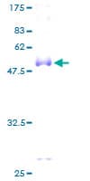 Human CD8A / CD8 Alpha Protein (Recombinant GST)