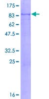 Human CDC6 Protein (Recombinant GST)