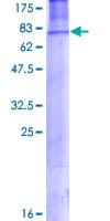 Human AP50 / AP2M1 Protein (Recombinant GST)
