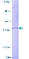 Human CRH / CRF Protein (Recombinant GST)