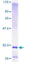 Human DEFB1 / BD-1 Protein (Recombinant GST)