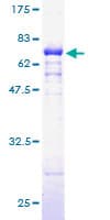 Human DHPS Protein (Recombinant GST)