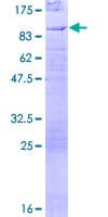 Human EYA2 Protein (Recombinant GST)