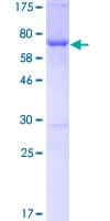 Human FASN / Fatty Acid Synthase Protein (Recombinant GST)