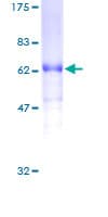 Human VEGFD Protein (Recombinant GST)