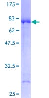 Human GCK / Glucokinase Protein (Recombinant GST)