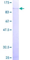 Human GLB1 / Beta-Galactosidase Protein (Recombinant GST)