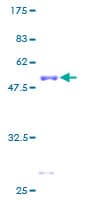 Human GRB2 Protein (Recombinant GST)