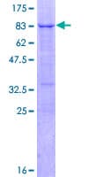 Human FOXA1 Protein (Recombinant GST, N-terminus)