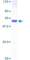 Human IKBKB / IKK2 / IKK Beta Protein (Recombinant GST)