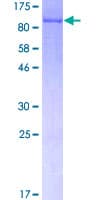 Human LIMK2 Protein (Recombinant GST)