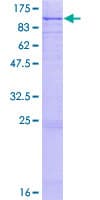 Human LF / LTF / Lactoferrin Protein (Recombinant GST)