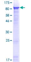 Human MME / CD10 Protein (Recombinant GST)