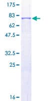 Human MMP1 Protein (Recombinant GST)