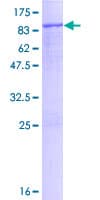 Human MMP2 Protein (Recombinant GST)
