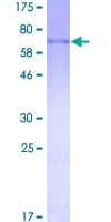 Human MMP8 Protein (Recombinant GST)