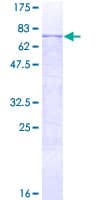Human MMP12 Protein (Recombinant GST)