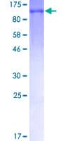 Human MSH2 Protein (Recombinant GST)