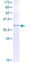 Human MSMB / MSP Protein (Recombinant GST)