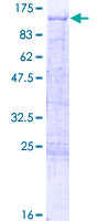 Human TBX2 Protein (Recombinant GST)