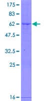 Human GGH / Gamma-Glutamyl Hydrolase Protein (Recombinant GST)