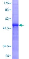 Human CCN4 / WISP1 Protein (Recombinant GST)