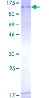 Human TOP3B Protein (Recombinant GST)