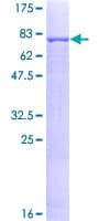 Human ANGPTL1 Protein (Recombinant GST)