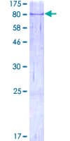 Human AIFM1 / AIF / PDCD8 Protein (Recombinant GST)