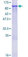 Human ARHGEF6 Protein (Recombinant GST)